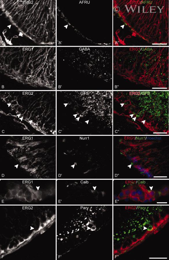 parvalbumin-antibody-pa1-933