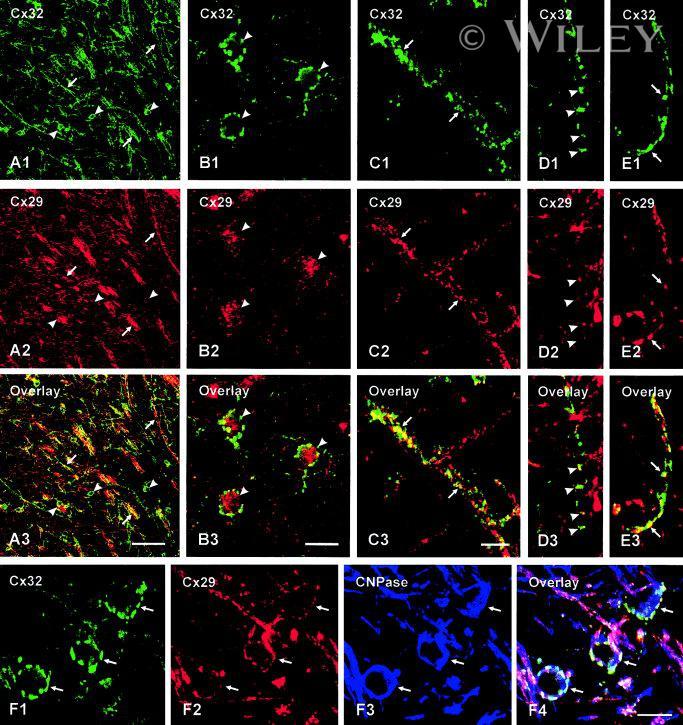 Connexin 32 Antibody (34-5700)