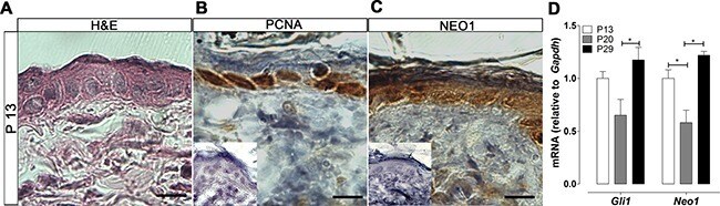 PCNA Antibody in Immunohistochemistry (IHC)