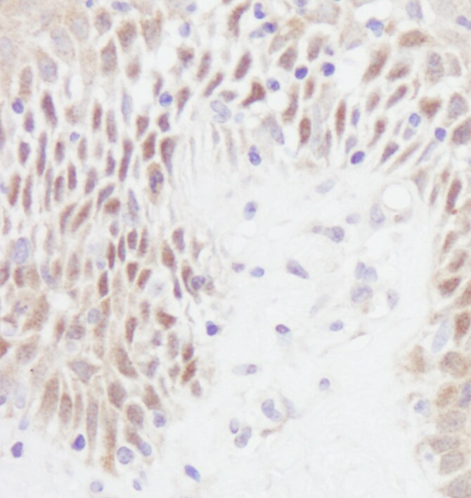 p53 Antibody in Immunohistochemistry (IHC)