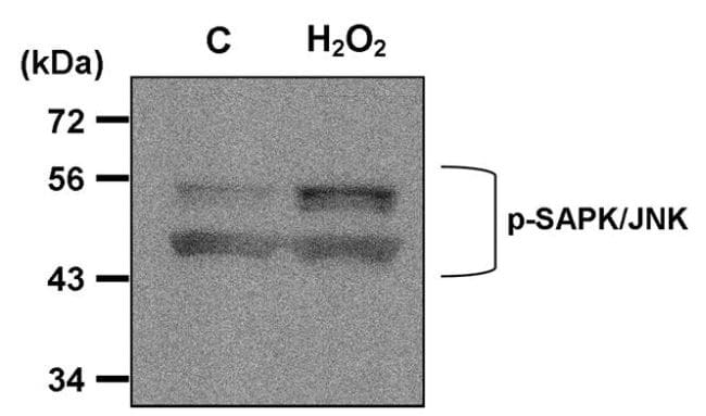 tbst in 5 milk Phospho (Thr183, Antibody JNK1/JNK2 Tyr185) F (Monoclonal,