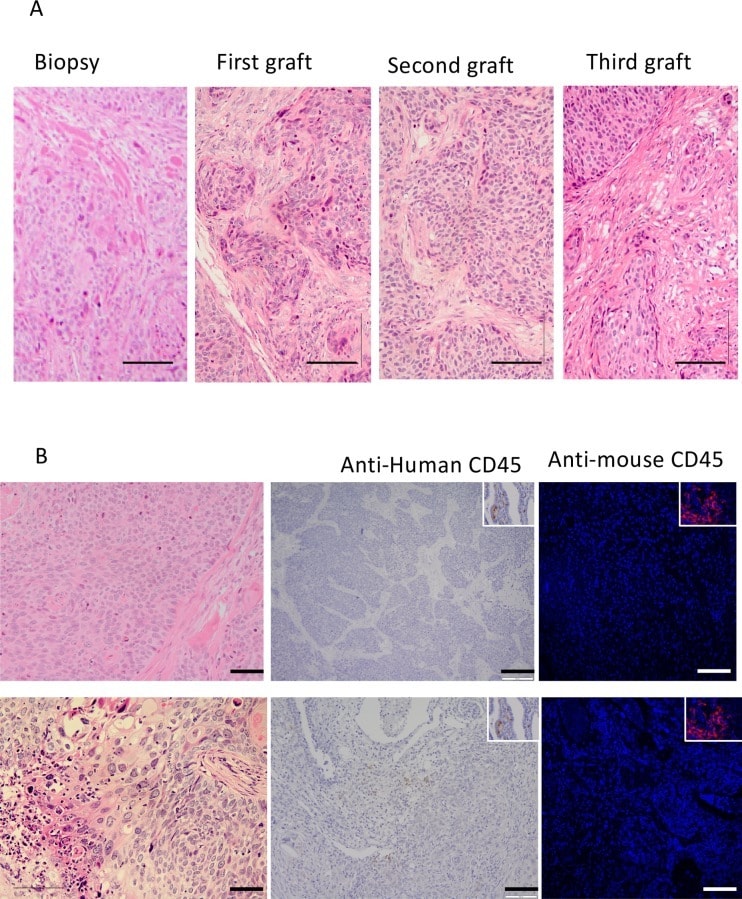 CD45 Antibody in Immunohistochemistry (IHC)