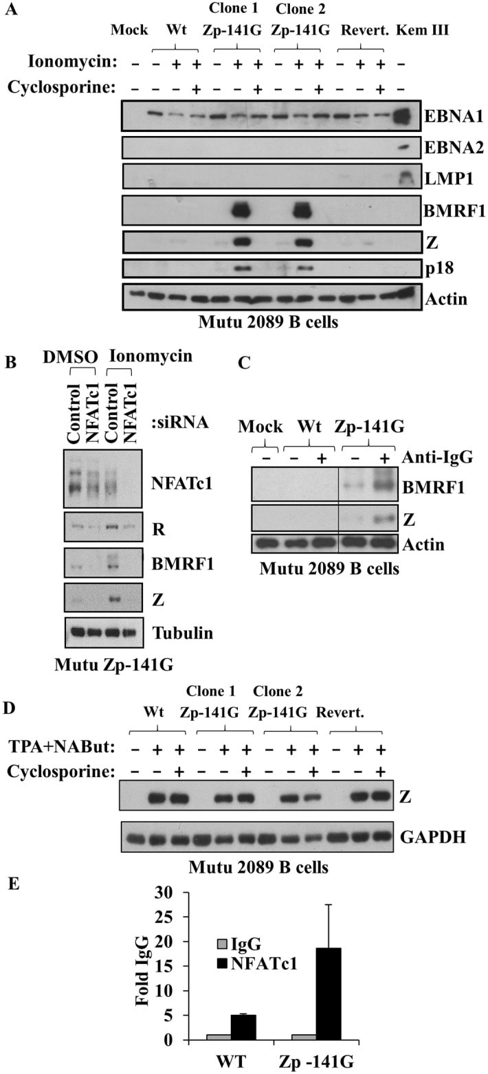 Epstein Barr Virus p18 Antibody (PA173003)