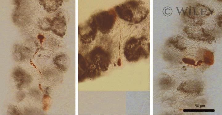 ATP4B Antibody in Immunohistochemistry (IHC)