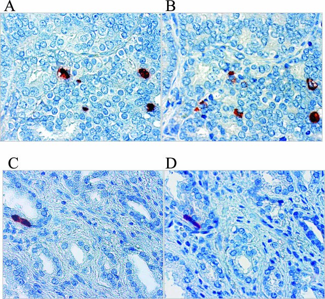 IL-8 (CXCL8) Antibody in Immunohistochemistry (IHC)