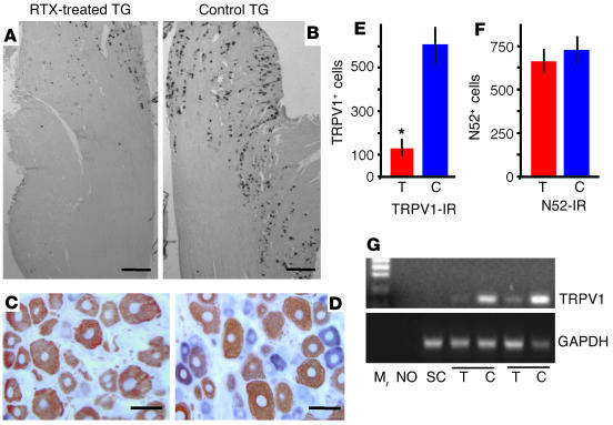 TRPV1 Antibody in Immunohistochemistry (IHC)