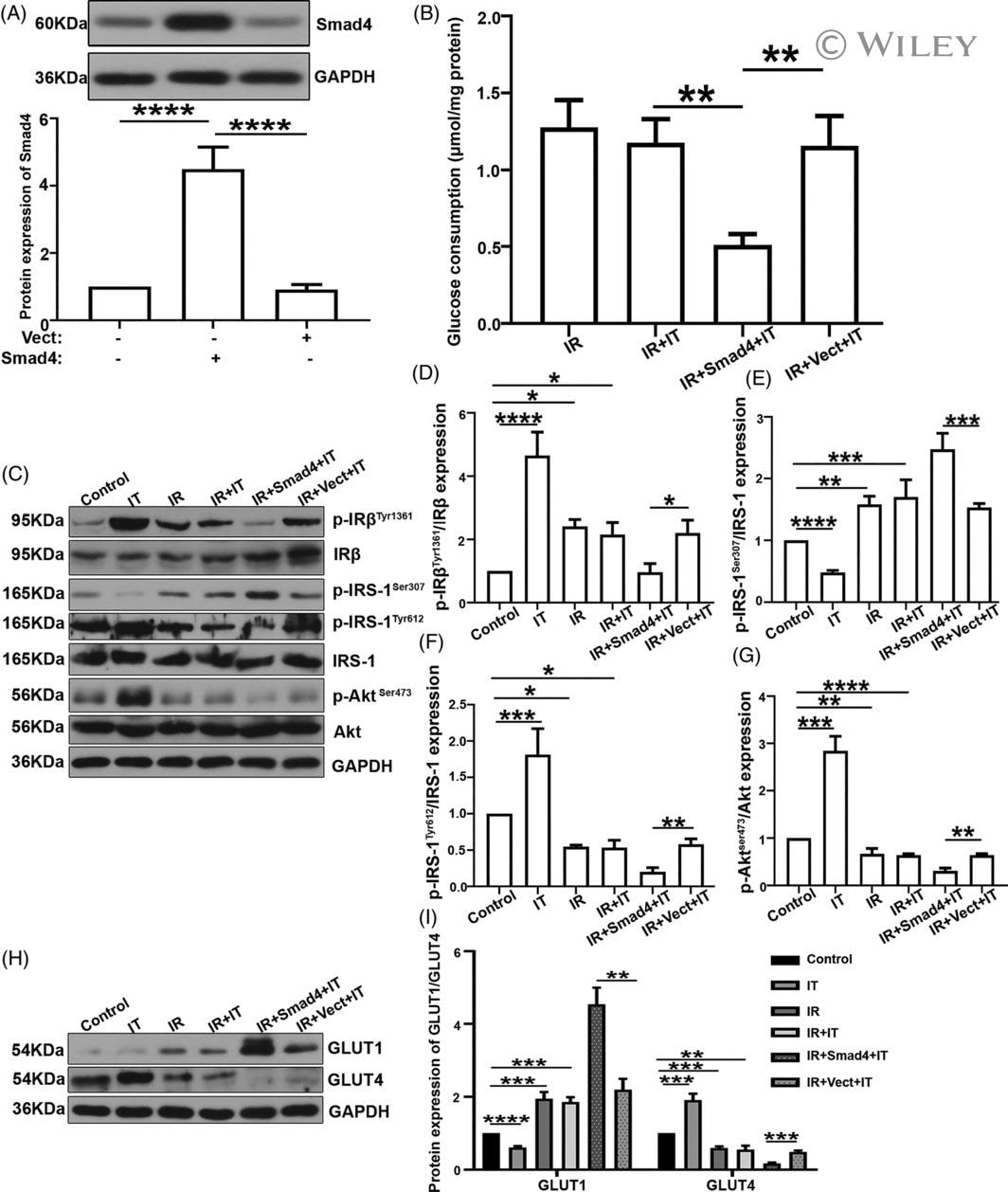 IRS1 Antibody in Western Blot (WB)