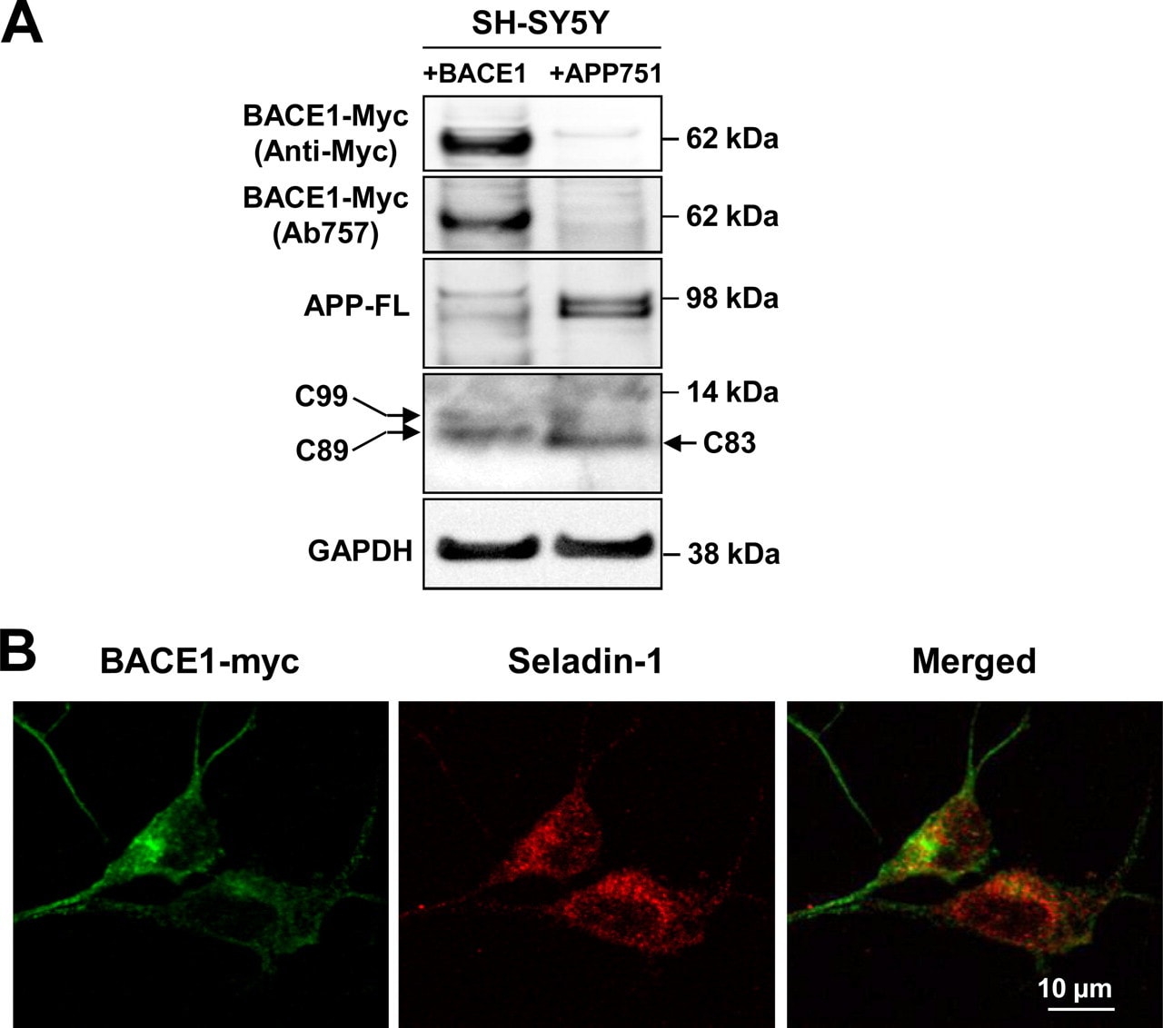 BACE1 Antibody in Western Blot (WB)