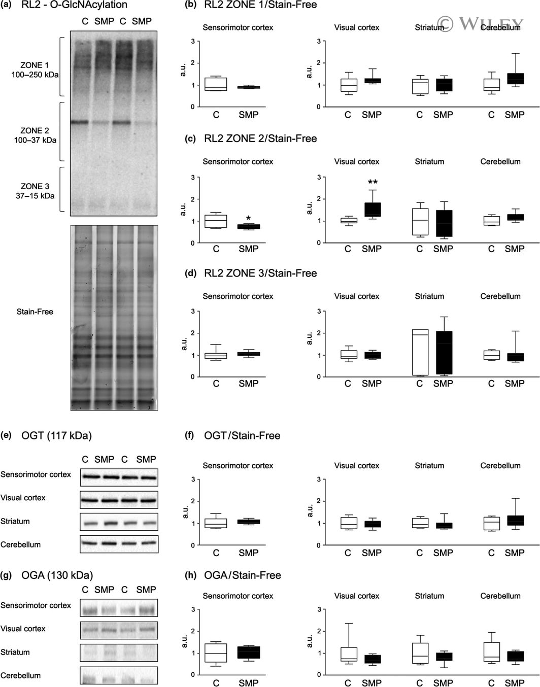 O Linked N Acetylglucosamine O Glcnac Antibody Ma1 072