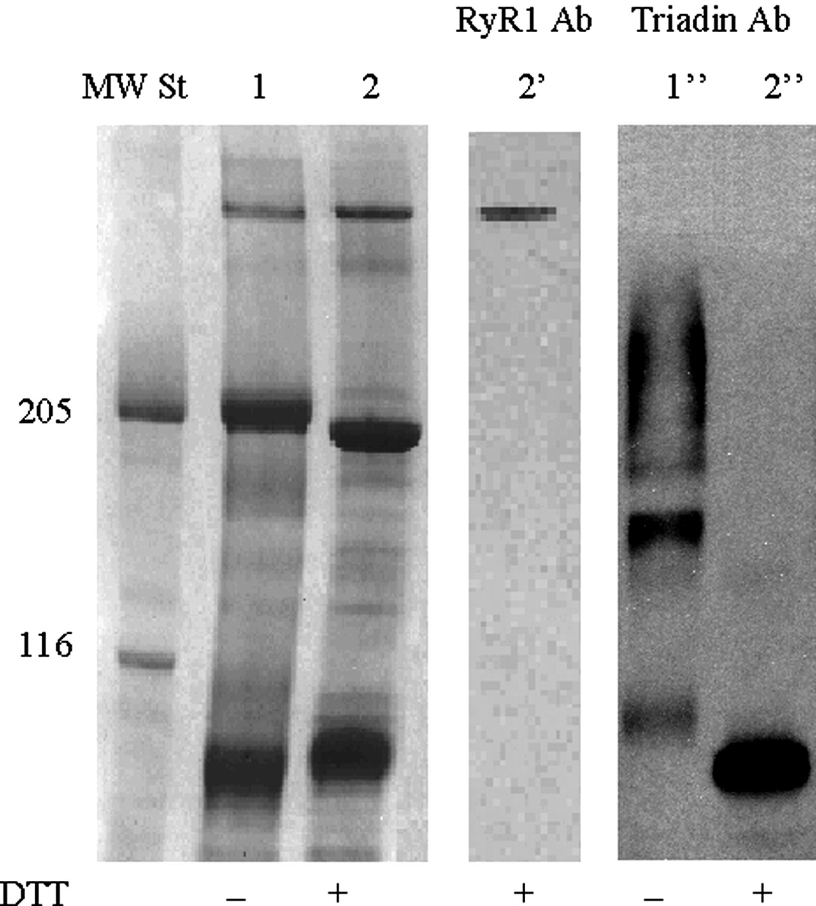 Triadin Antibody in Western Blot (WB)