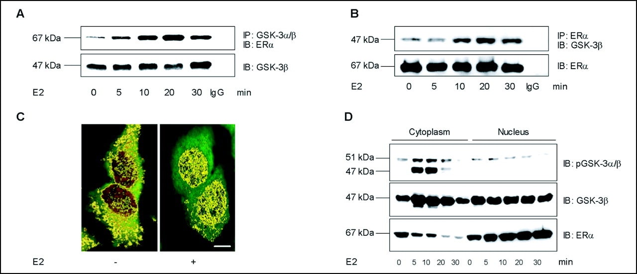 GSK3 alpha/beta Antibody in Western Blot, Immunocytochemistry, Immunoprecipitation (WB, ICC/IF, IP)