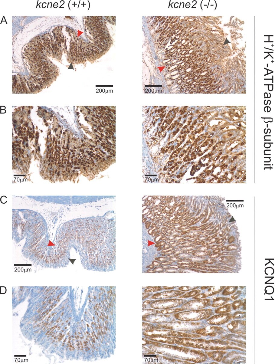 ATP4B Antibody in Immunohistochemistry (IHC)