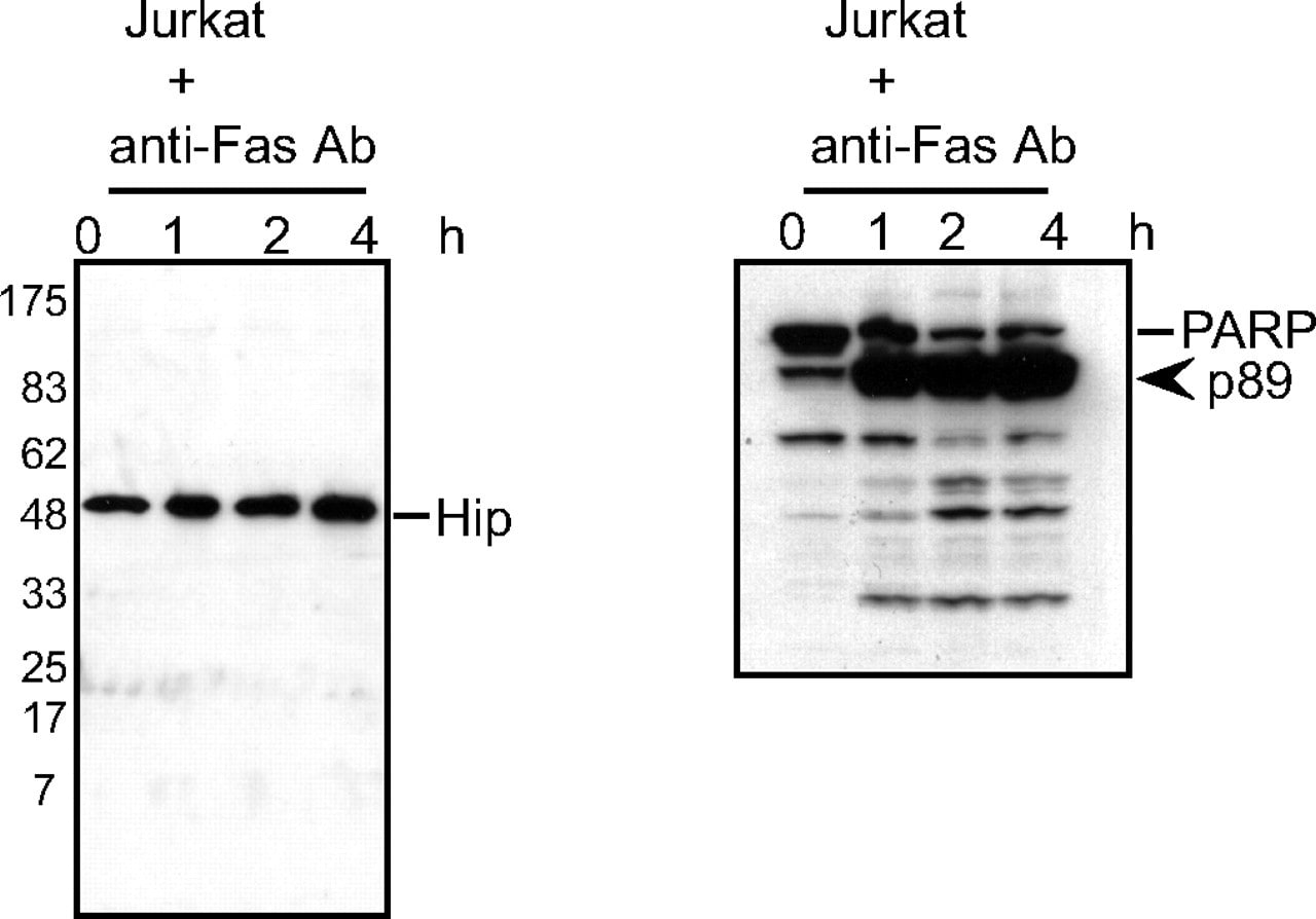 HIP Antibody in Western Blot (WB)