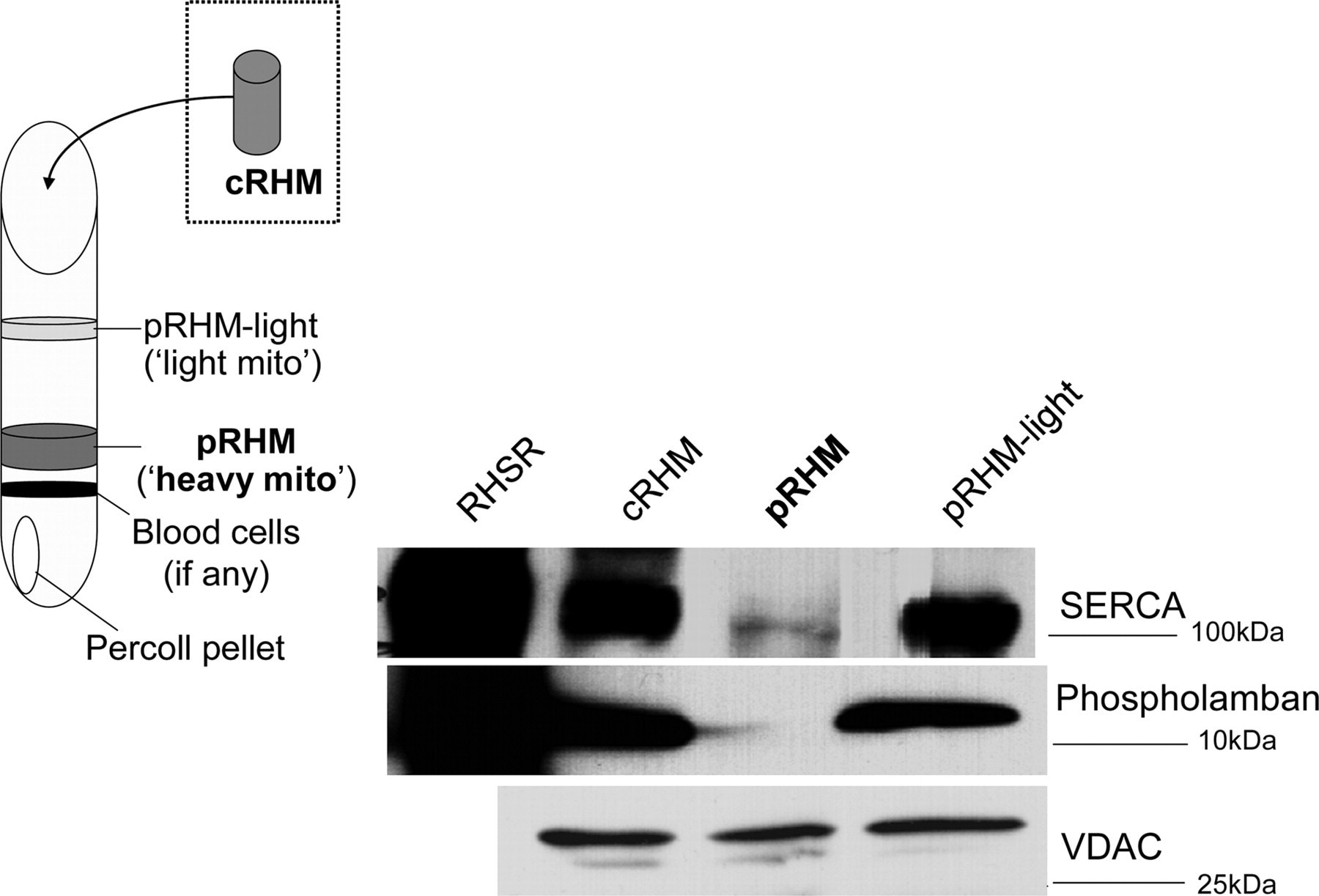 VDAC Antibody in Western Blot (WB)