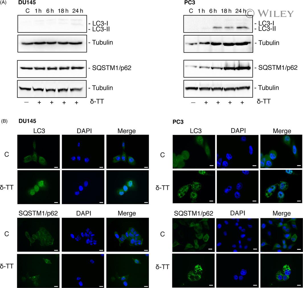 SQSTM1 Antibody in Western Blot, Immunocytochemistry (WB, ICC/IF)
