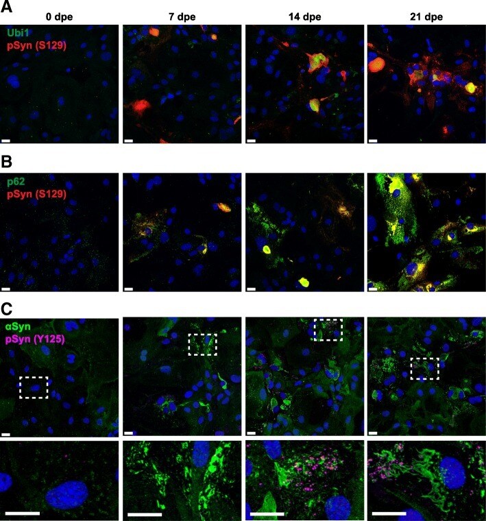 alpha Synuclein Antibody in Immunocytochemistry (ICC/IF)