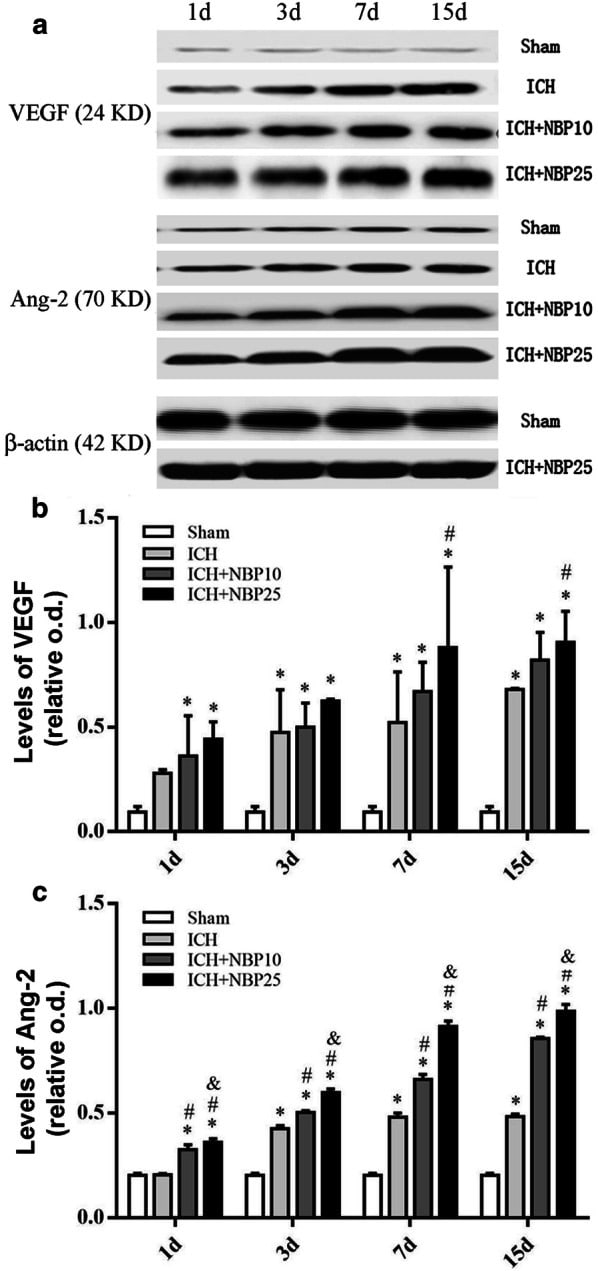 beta Actin Antibody (PA116889)