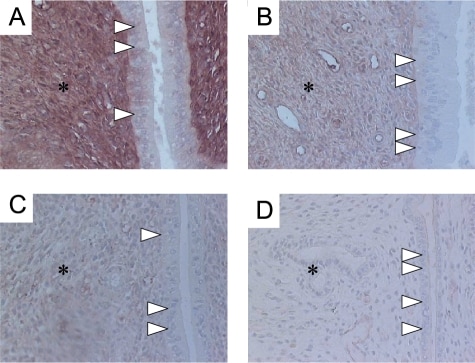 Estrogen Receptor beta Antibody