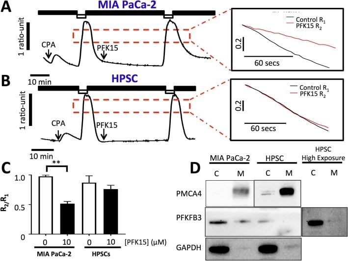 PMCA4 ATPase Antibody in Western Blot (WB)