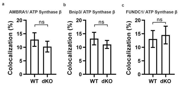ATP Synthase beta Antibody in Immunocytochemistry (ICC/IF)