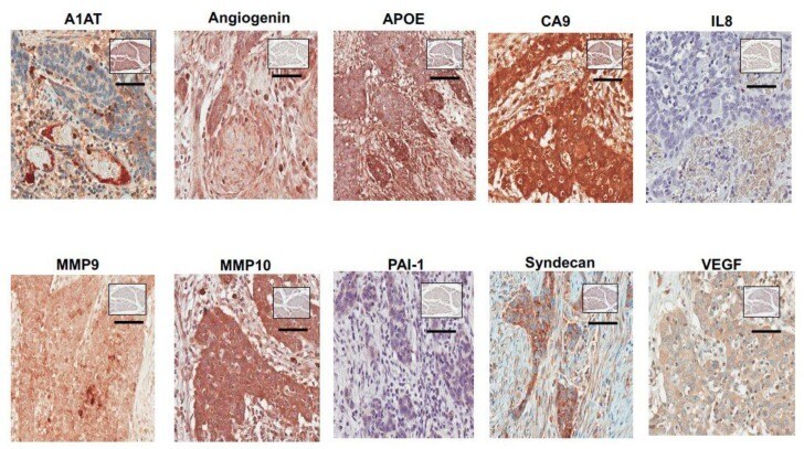 IL-8 (CXCL8) Antibody in Immunohistochemistry (IHC)