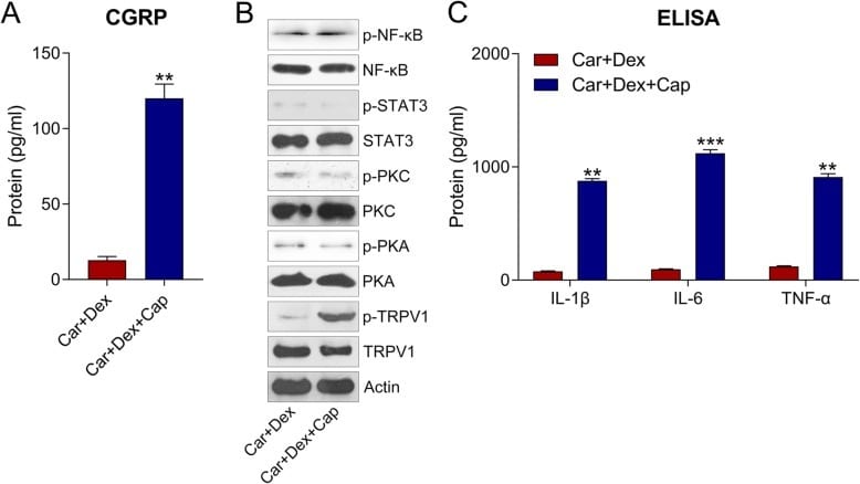 TRPV1 Antibody in Western Blot (WB)