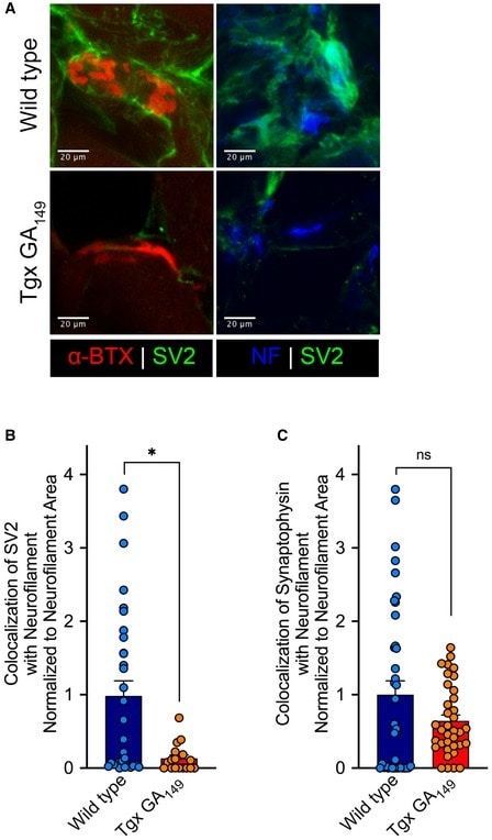 Synaptophysin Antibody in Immunocytochemistry (ICC/IF)