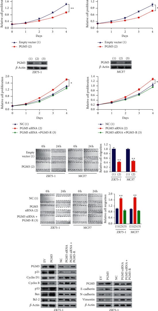 PGM5 Antibody in Western Blot (WB)