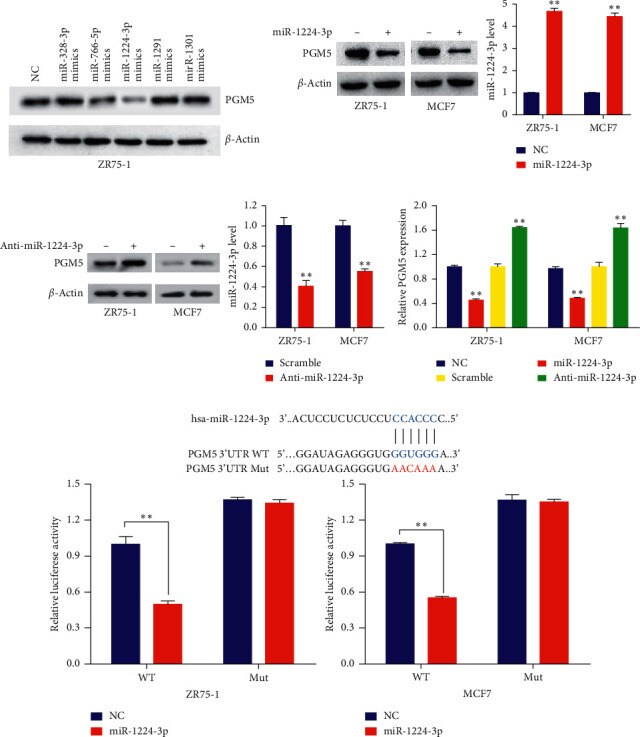 PGM5 Antibody in Western Blot (WB)