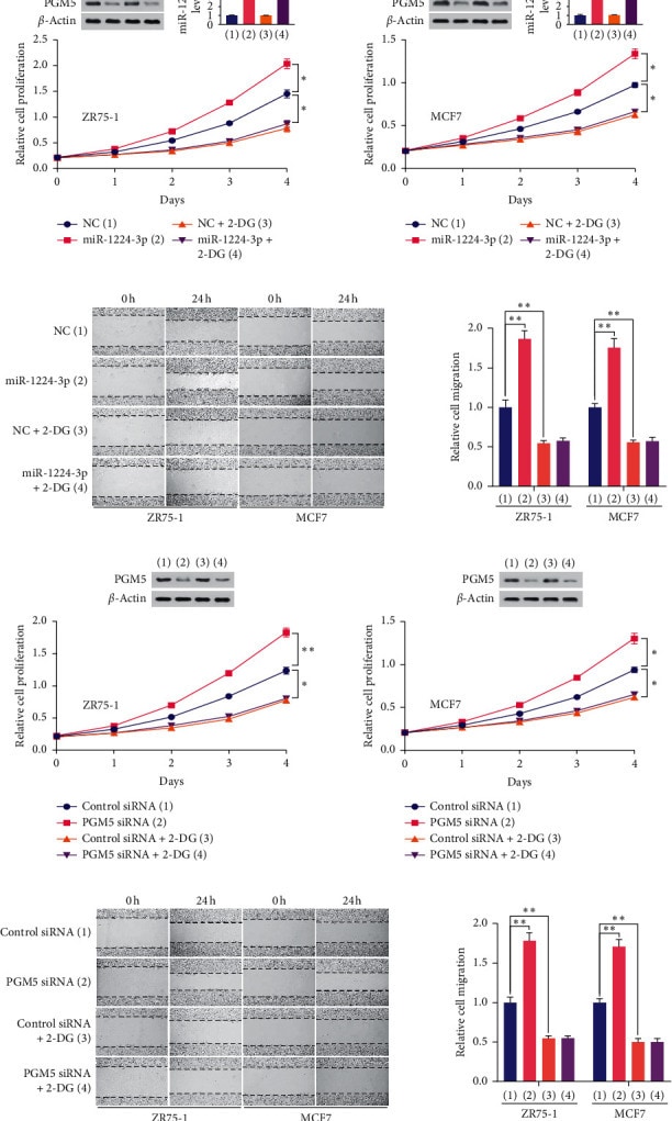 PGM5 Antibody in Western Blot (WB)