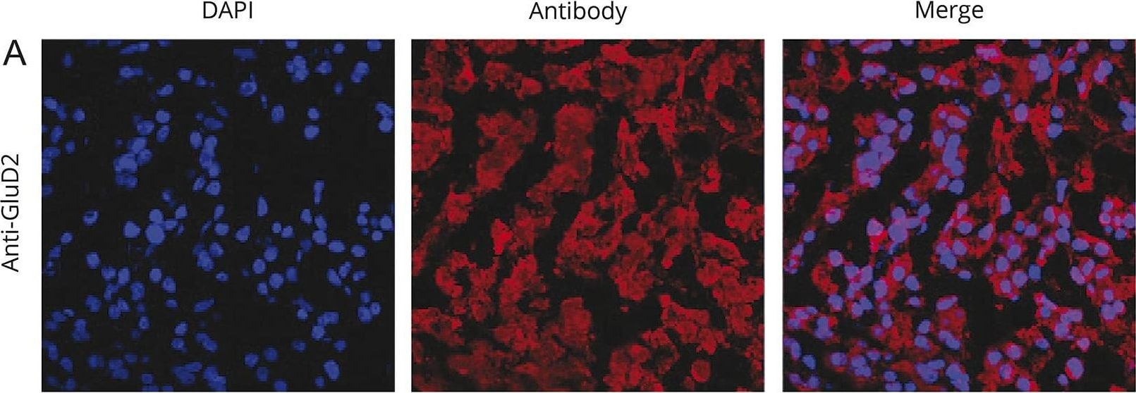 Rabbit IgG (H+L) Cross-Adsorbed Secondary Antibody in Immunohistochemistry (IHC)