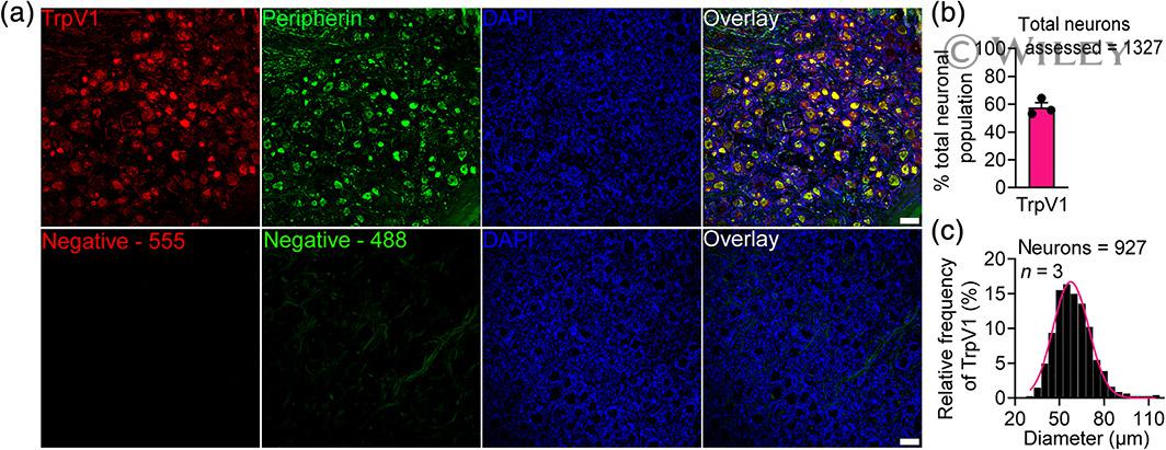 TRPV1 Antibody in Immunohistochemistry (IHC)