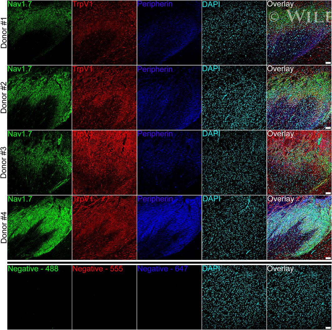 TRPV1 Antibody in Immunohistochemistry (IHC)