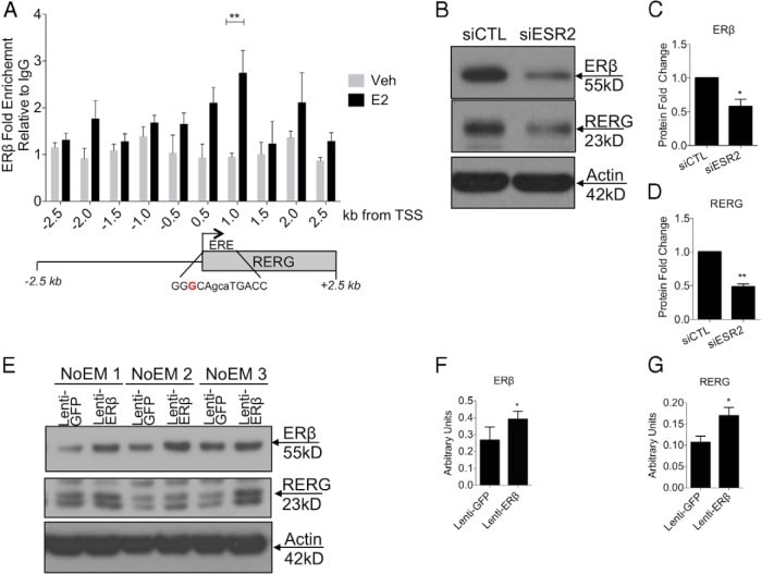 Estrogen Receptor beta Antibody in ChIP Assay (ChIP)