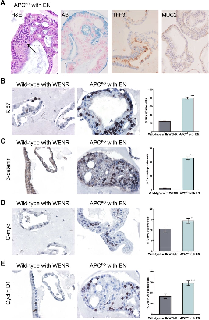 Cyclin D1 Antibody in Immunohistochemistry (IHC)