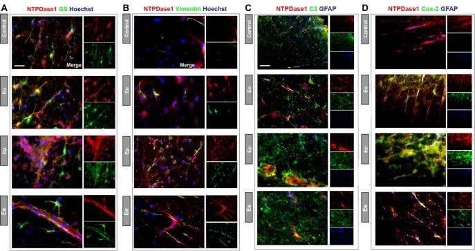 Complement C3 Antibody in Immunohistochemistry (IHC)