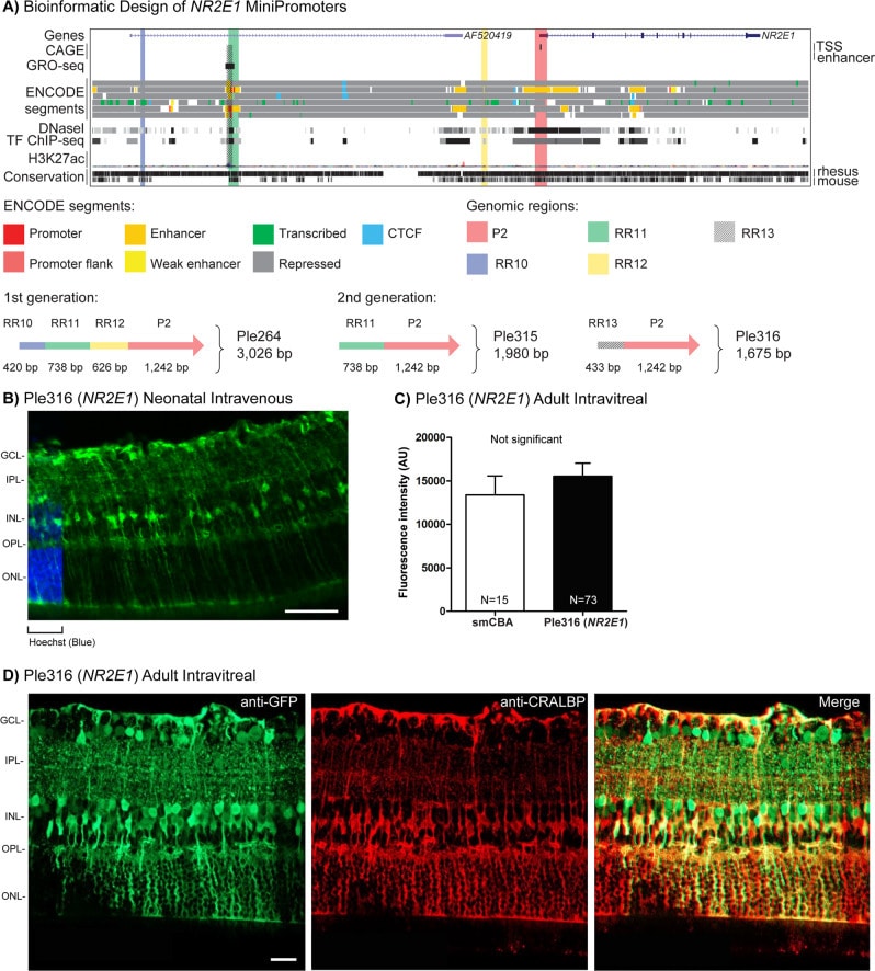 CRALBP Antibody in Immunohistochemistry (IHC)