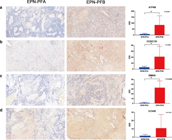 ATP4B Antibody in Immunohistochemistry (IHC)