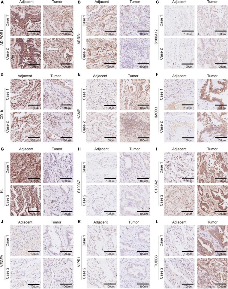 VIPR1 Antibody in Immunohistochemistry (IHC)