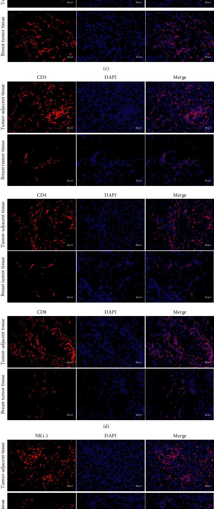 CD4 Antibody in Immunohistochemistry (IHC)