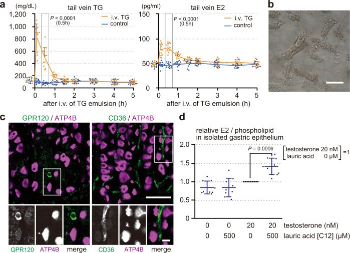 ATP4B Antibody in Immunohistochemistry (IHC)