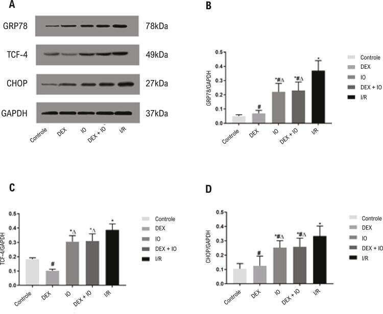 GRP78 Antibody in Western Blot (WB)