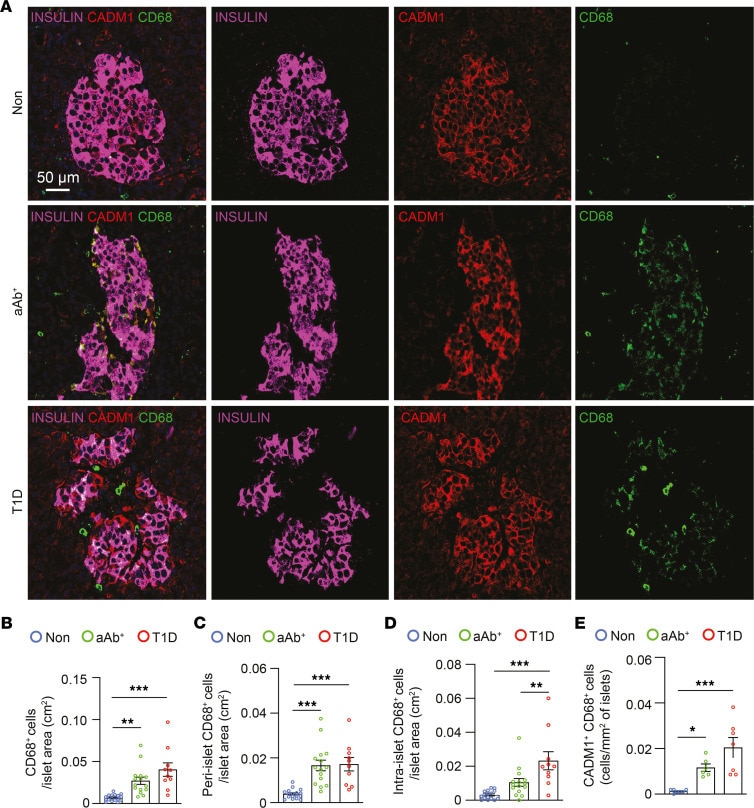 Insulin Antibody in Immunohistochemistry (IHC)