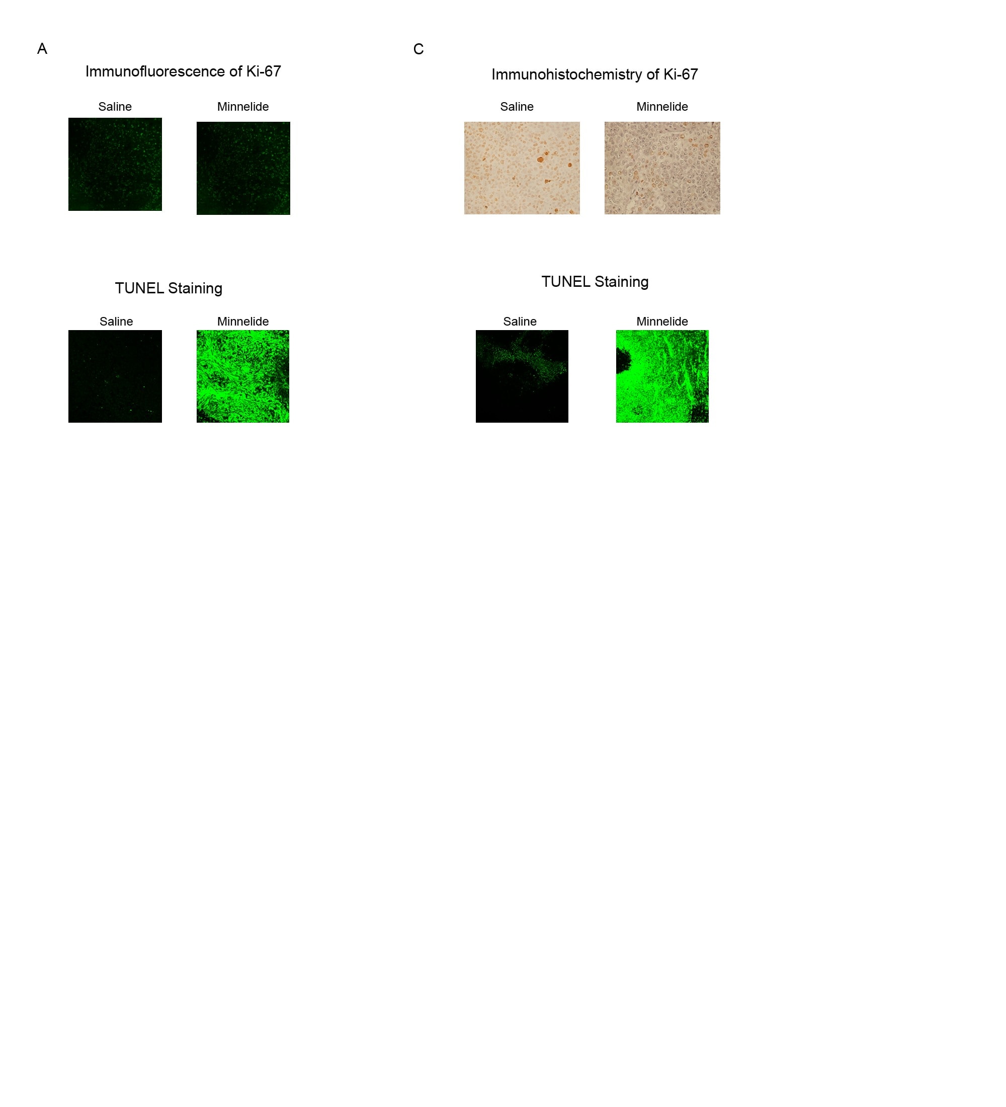 Ki 67 Antibody Ma5 14520