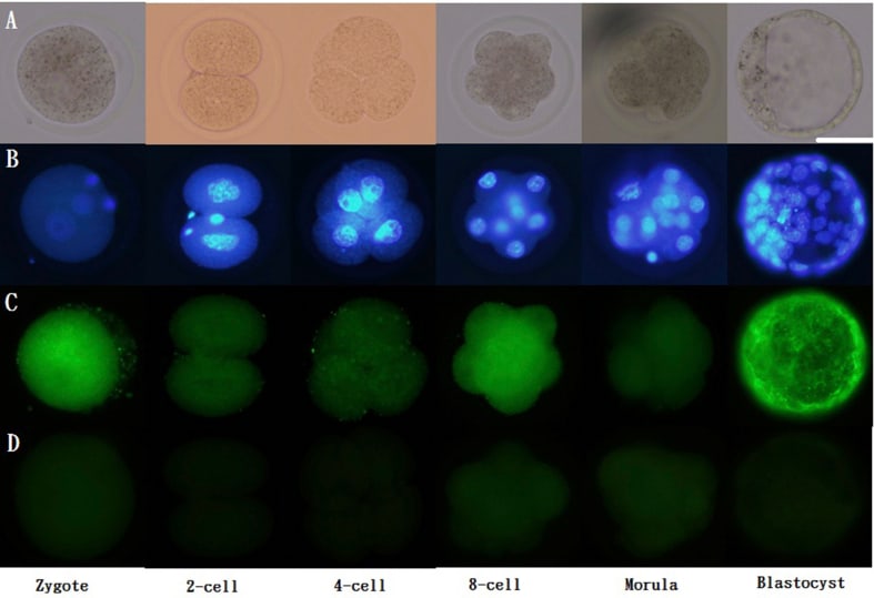 Estrogen Receptor beta Antibody in Immunocytochemistry (ICC/IF)