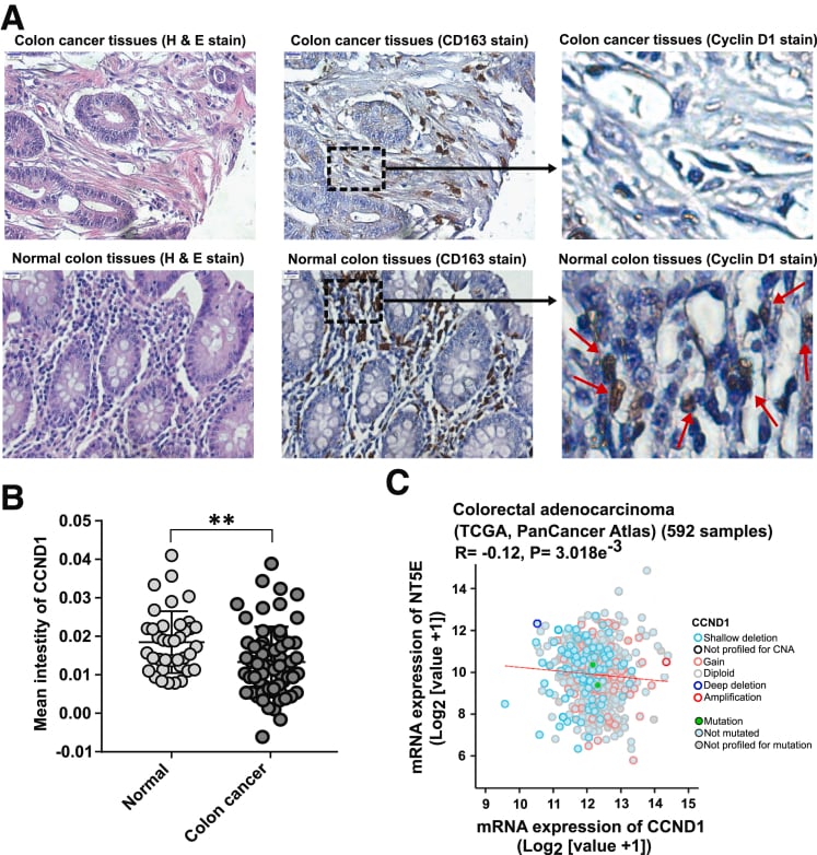 Cyclin D1 Antibody in Immunohistochemistry (IHC)