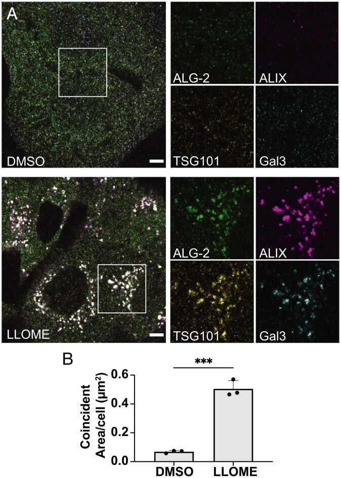 Alix Antibody in Immunocytochemistry (ICC/IF)