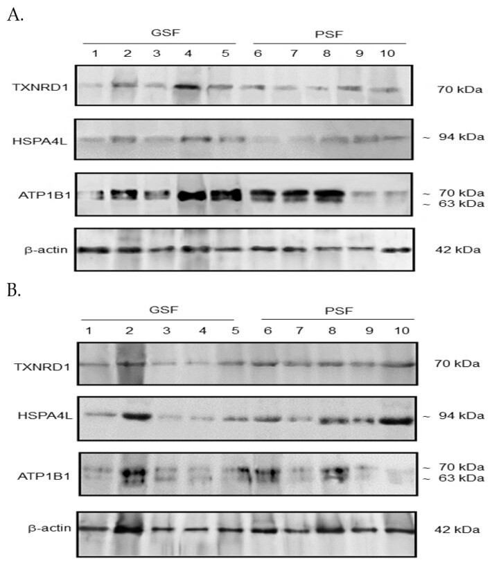 ATP1B1 Antibody in Western Blot (WB)