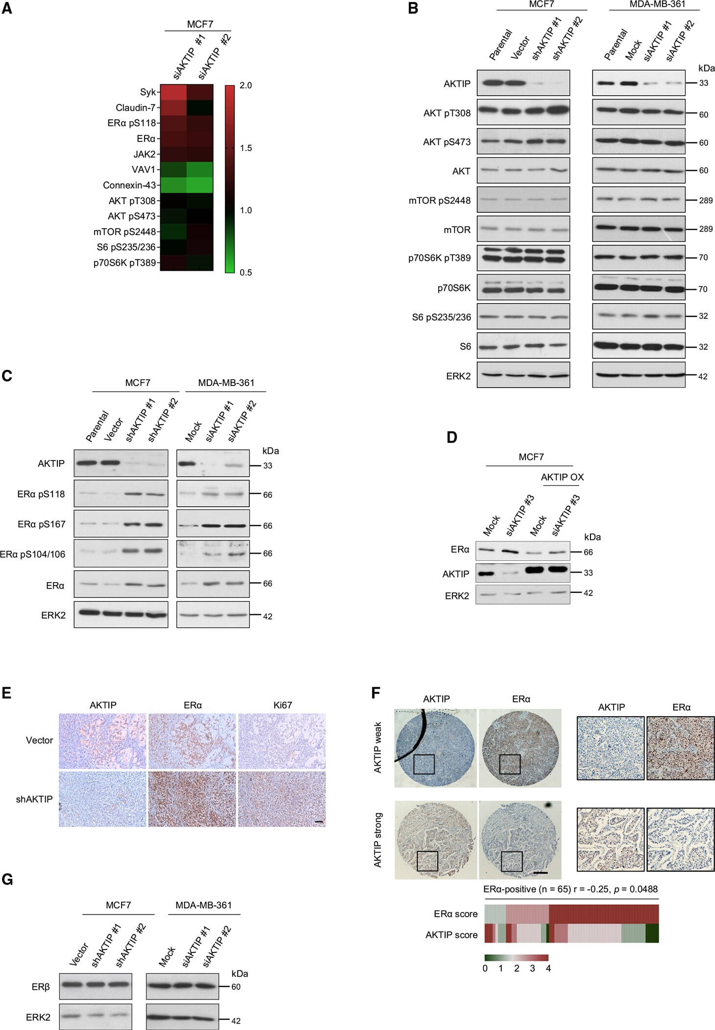 Estrogen Receptor beta Antibody in Western Blot (WB)