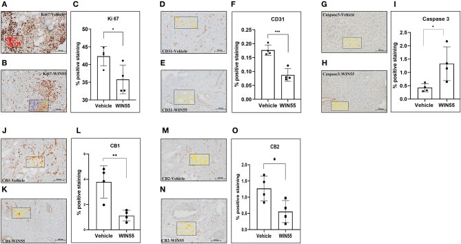 Cannabinoid Receptor 1 Antibody in Immunohistochemistry (IHC)